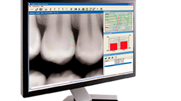 Dental Imaging Software